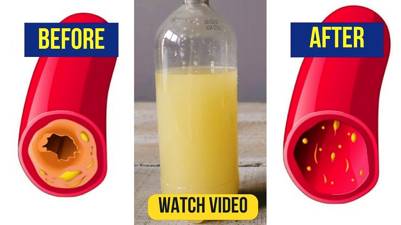 Lemon, Garlic and Ginger Recipe to Lower Cholesterol, Remove Infection